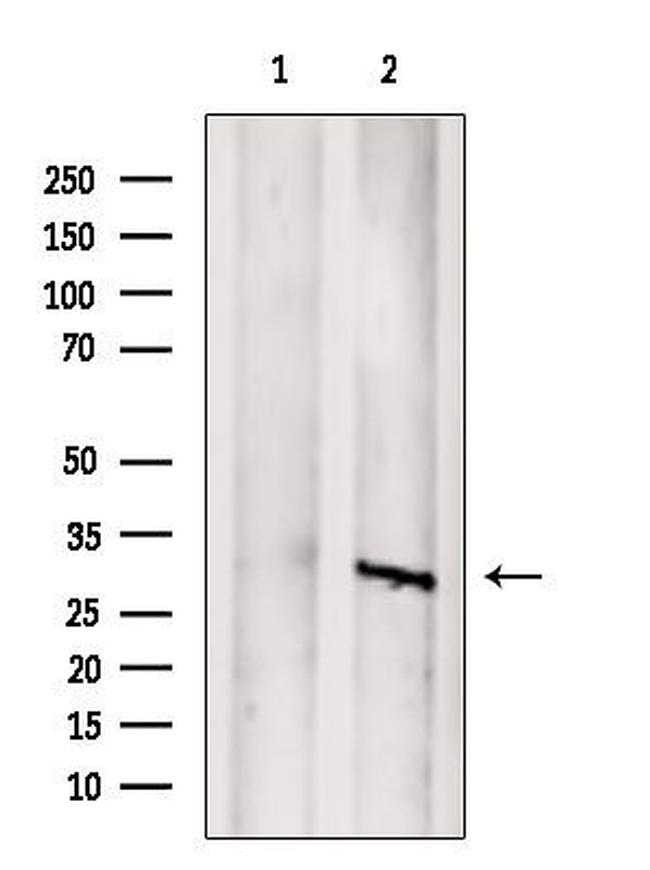 SAT1 Antibody in Western Blot (WB)