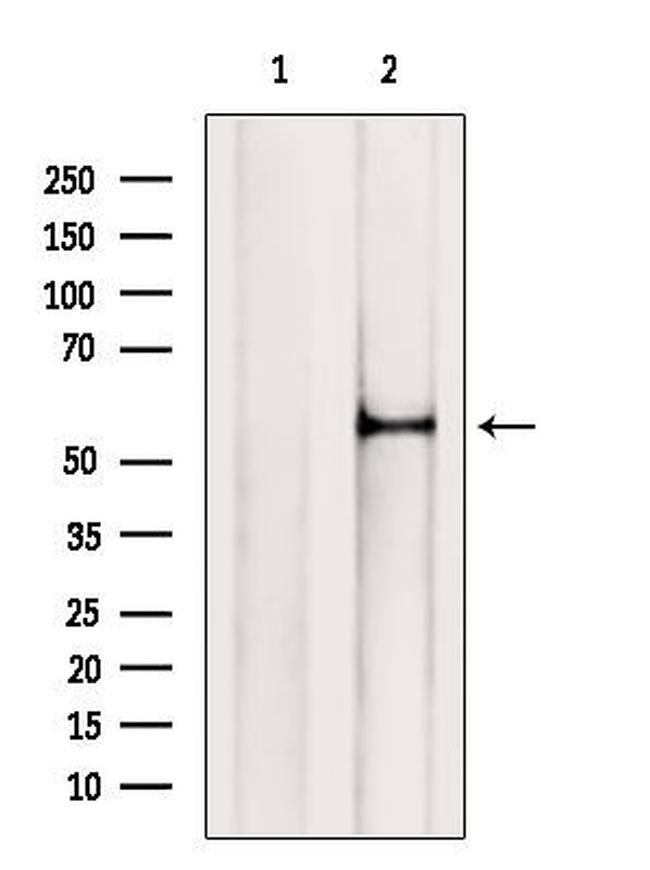 SLC13A2 Antibody in Western Blot (WB)