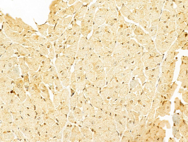 VPS11 Antibody in Immunohistochemistry (Paraffin) (IHC (P))