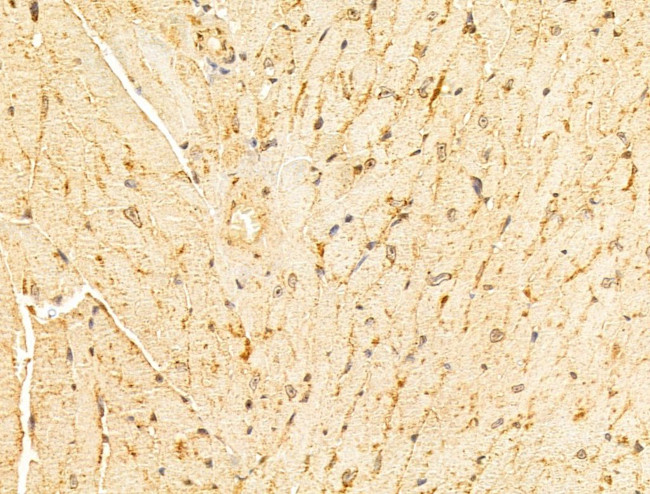 VPS11 Antibody in Immunohistochemistry (Paraffin) (IHC (P))