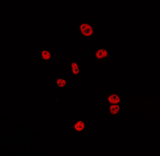 CSTF2 Antibody in Immunocytochemistry (ICC/IF)