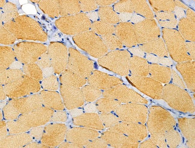 alpha Actinin 2/3 Antibody in Immunohistochemistry (Paraffin) (IHC (P))