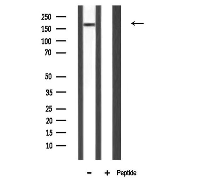 MAST2 Antibody in Western Blot (WB)