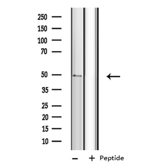 CYP4B1 Antibody in Western Blot (WB)