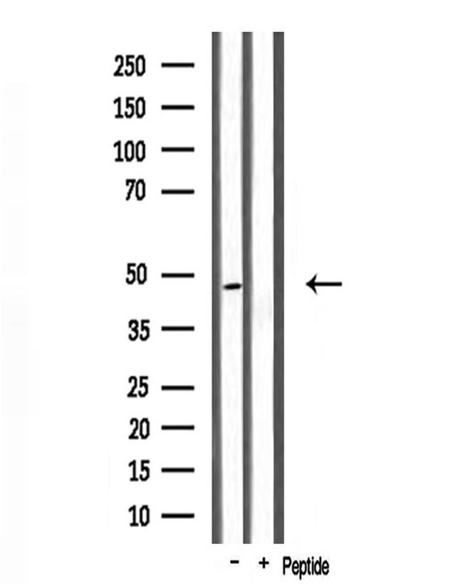 ABHD2 Antibody in Western Blot (WB)