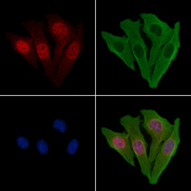 Calpain 10 Antibody in Immunocytochemistry (ICC/IF)