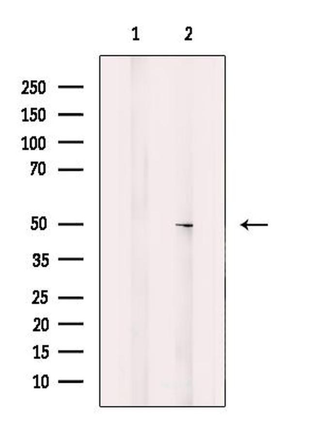 CHST10 Antibody in Western Blot (WB)