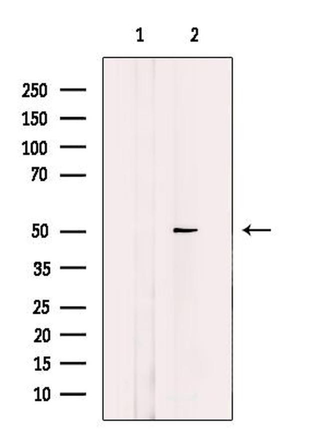 EFEMP2 Antibody in Western Blot (WB)