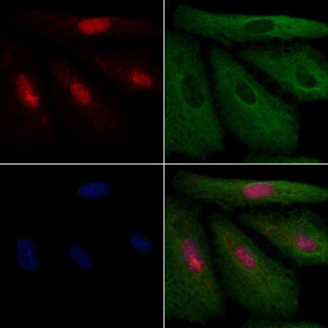 MSX2 Antibody in Immunocytochemistry (ICC/IF)