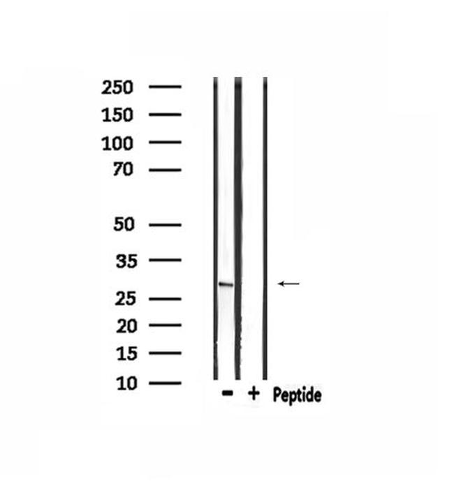 MSX2 Antibody in Western Blot (WB)