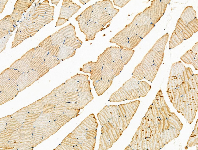 MRPL39 Antibody in Immunohistochemistry (Paraffin) (IHC (P))