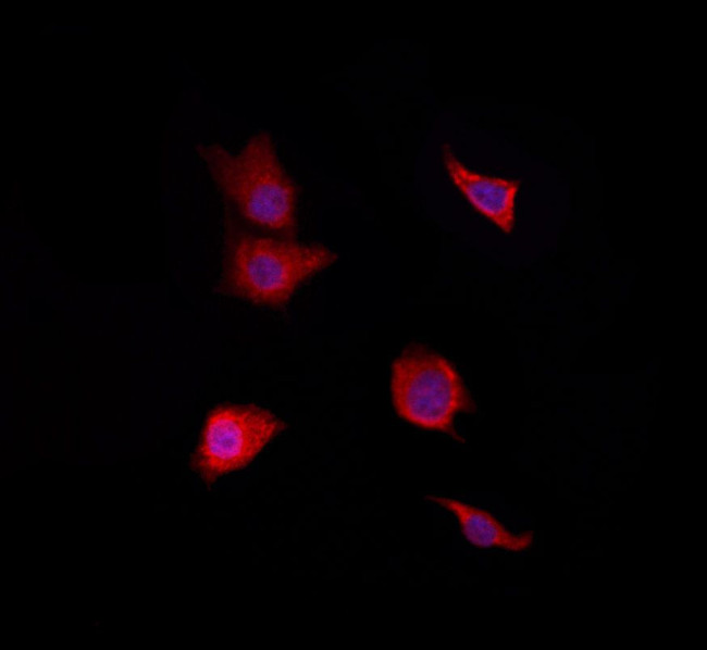 RAB38 Antibody in Immunocytochemistry (ICC/IF)