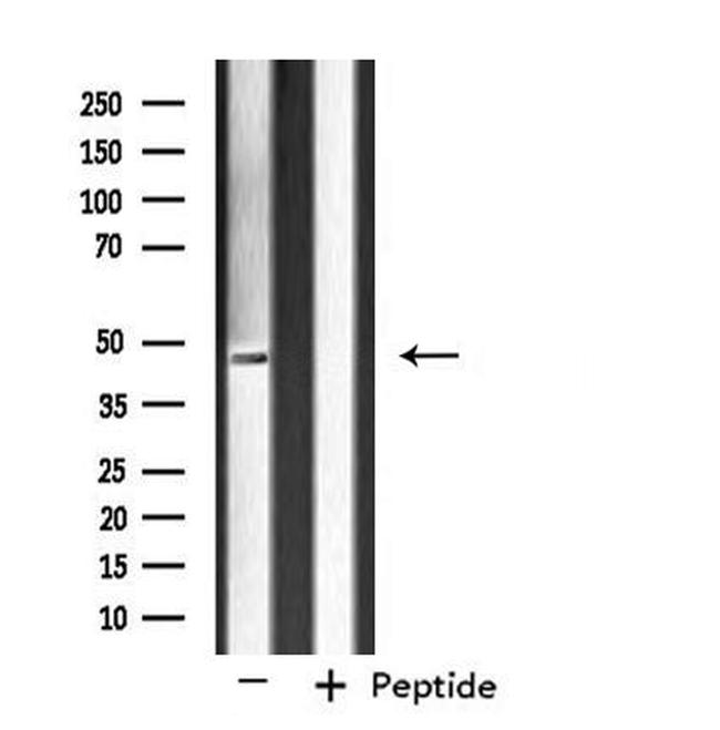 SIRPB1 Antibody in Western Blot (WB)