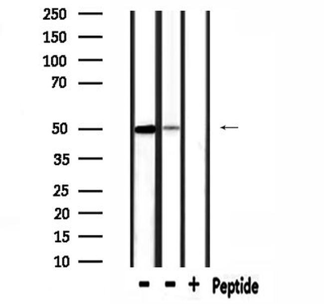 SLC38A2 Antibody in Western Blot (WB)