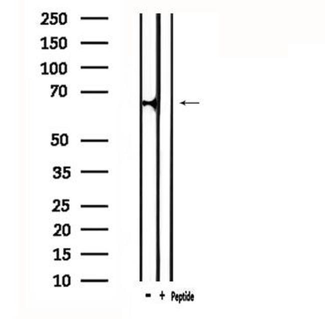 ATG16L2 Antibody in Western Blot (WB)