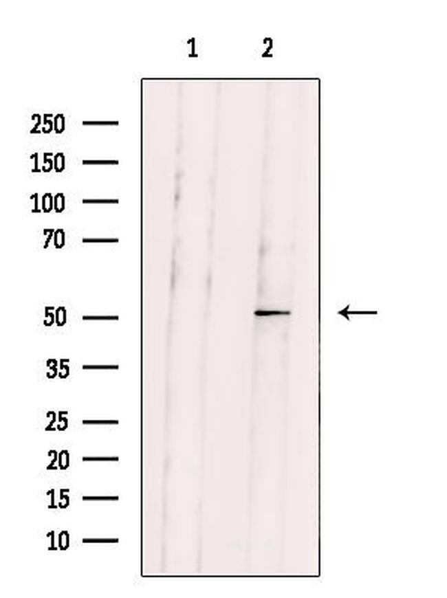 GPR152 Antibody in Western Blot (WB)