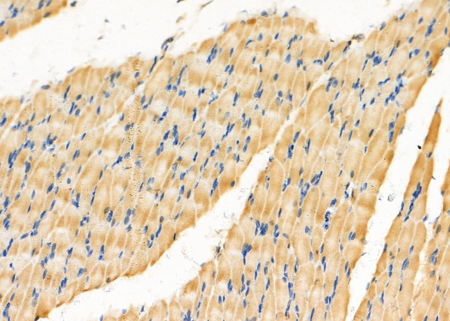 GPRC5B Antibody in Immunohistochemistry (Paraffin) (IHC (P))