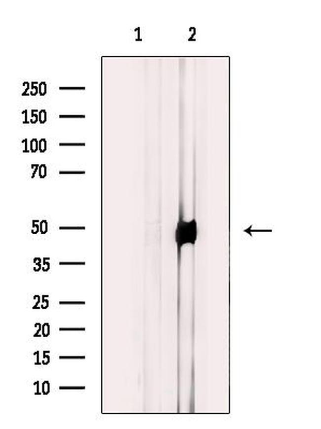GPRC5B Antibody in Western Blot (WB)