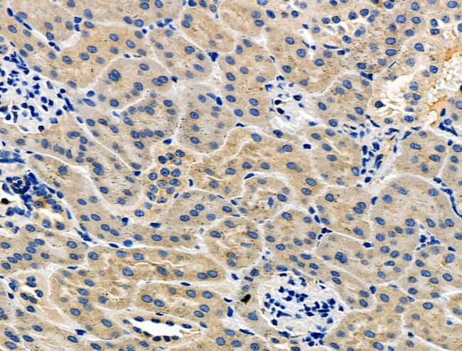 STAR Antibody in Immunohistochemistry (Paraffin) (IHC (P))