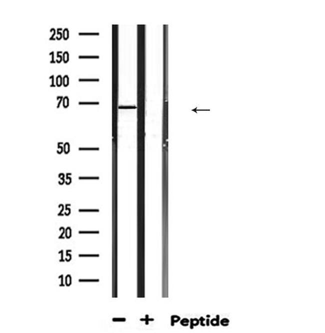 HSP701L Antibody in Western Blot (WB)