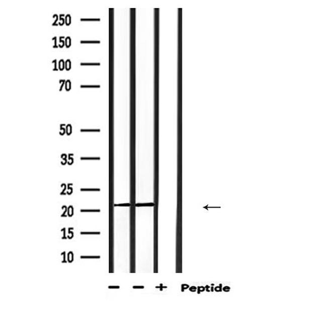 PRDX2 Antibody in Western Blot (WB)