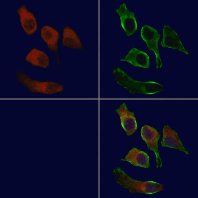 E-selectin Antibody in Immunocytochemistry (ICC/IF)