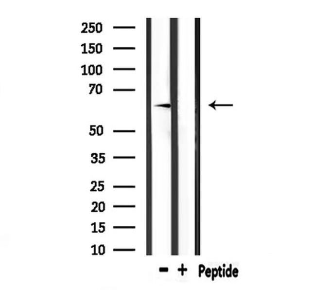 E-selectin Antibody in Western Blot (WB)