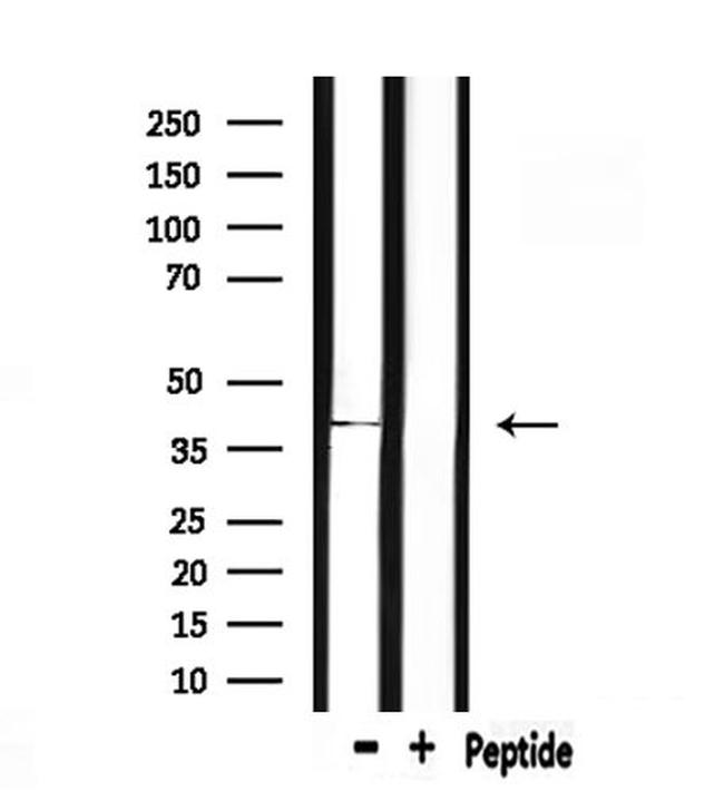 ACP5 Antibody in Western Blot (WB)