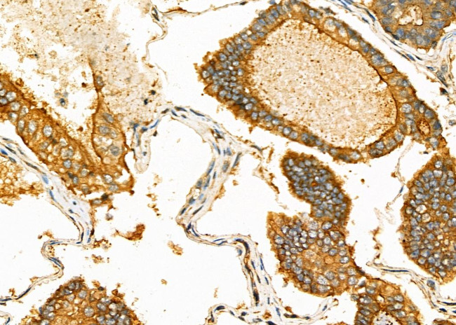 ACP5 Antibody in Immunohistochemistry (Paraffin) (IHC (P))