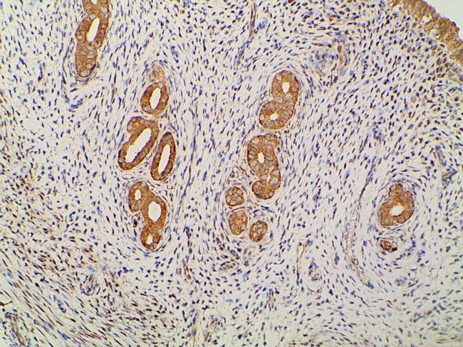 Ephrin B2 Antibody in Immunohistochemistry (Paraffin) (IHC (P))