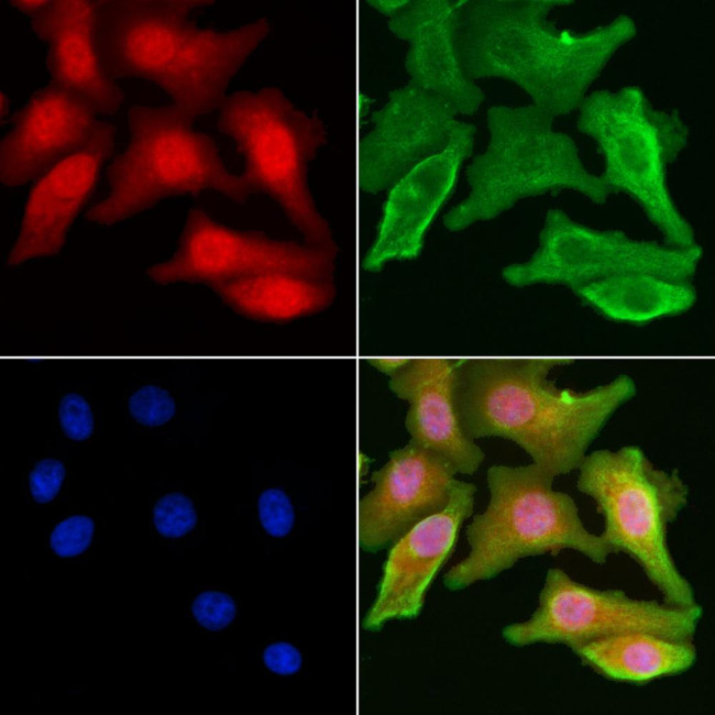 DAP Antibody in Immunocytochemistry (ICC/IF)