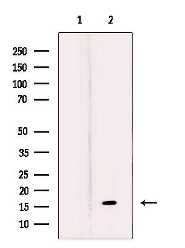 MRPL27 Antibody in Western Blot (WB)
