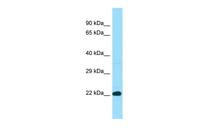 BLOC1S3 Antibody in Western Blot (WB)