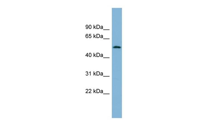 CNOT11 Antibody in Western Blot (WB)