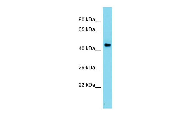 ADC Antibody in Western Blot (WB)