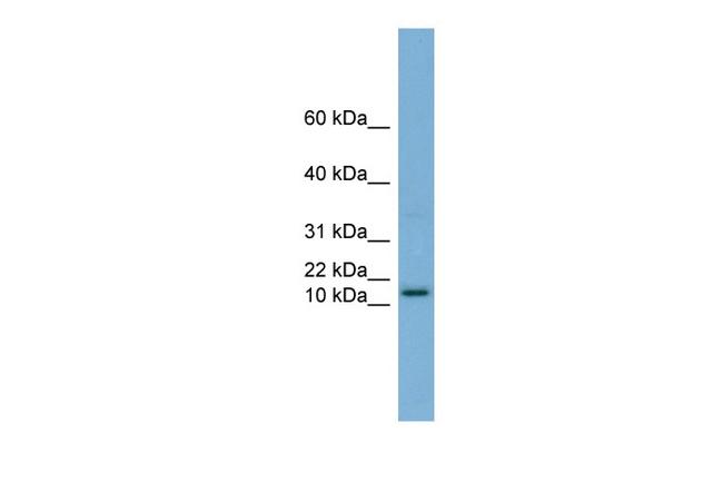 HRK Antibody in Western Blot (WB)