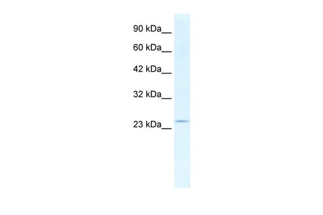 SOX14 Antibody in Western Blot (WB)