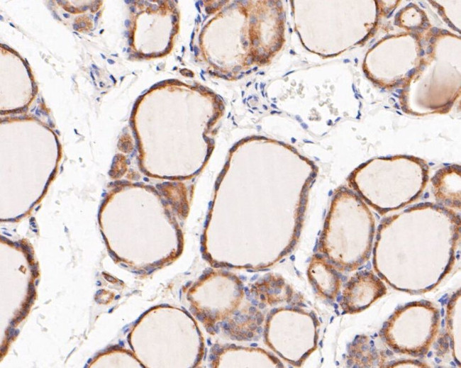 FBP1 Antibody in Immunohistochemistry (Paraffin) (IHC (P))