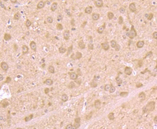 TSPO Antibody in Immunohistochemistry (Paraffin) (IHC (P))