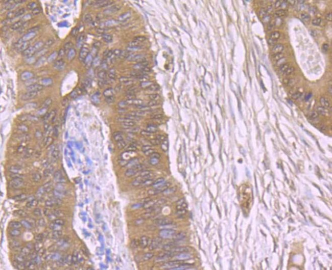 TSPO Antibody in Immunohistochemistry (Paraffin) (IHC (P))