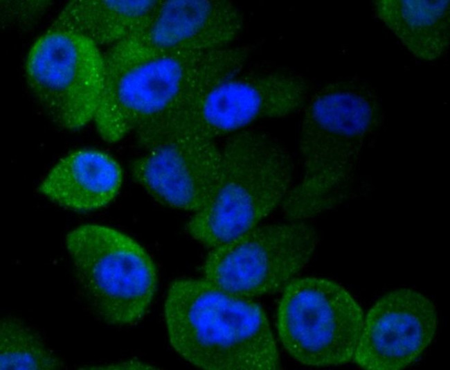 LC3A/LC3B Antibody in Immunocytochemistry (ICC/IF)