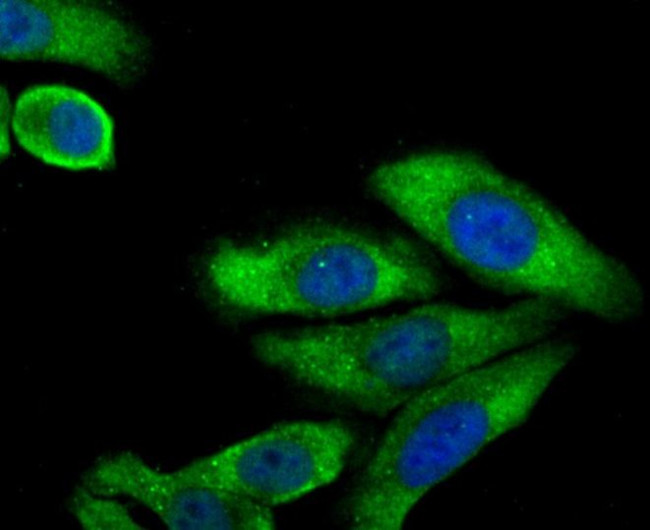 LC3A/LC3B Antibody in Immunocytochemistry (ICC/IF)