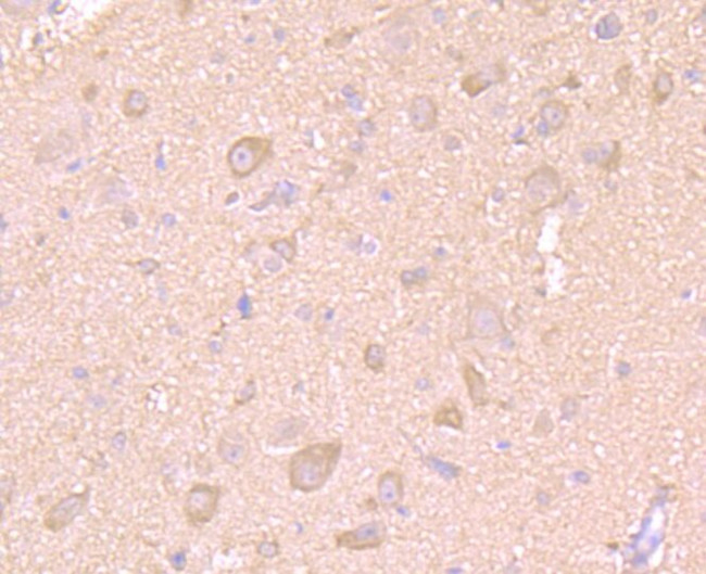 LC3A/LC3B Antibody in Immunohistochemistry (Paraffin) (IHC (P))