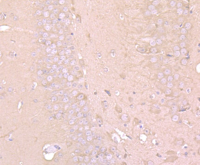 LC3A/LC3B Antibody in Immunohistochemistry (Paraffin) (IHC (P))