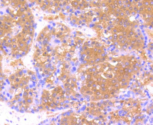 USP21 Antibody in Immunohistochemistry (Paraffin) (IHC (P))