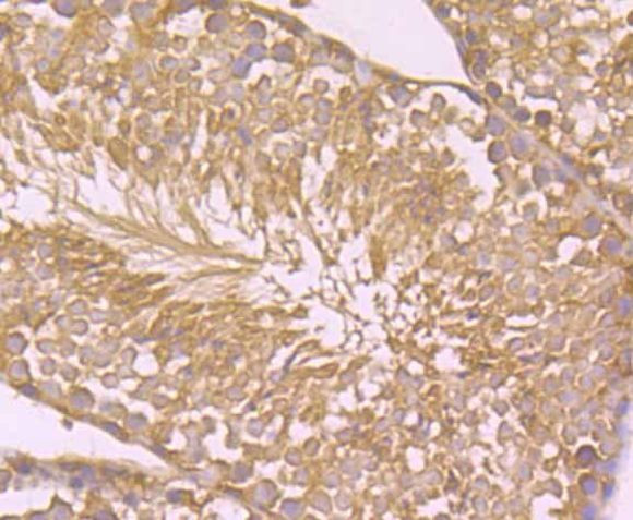 CD266 (TWEAK Receptor) Antibody in Immunohistochemistry (Paraffin) (IHC (P))