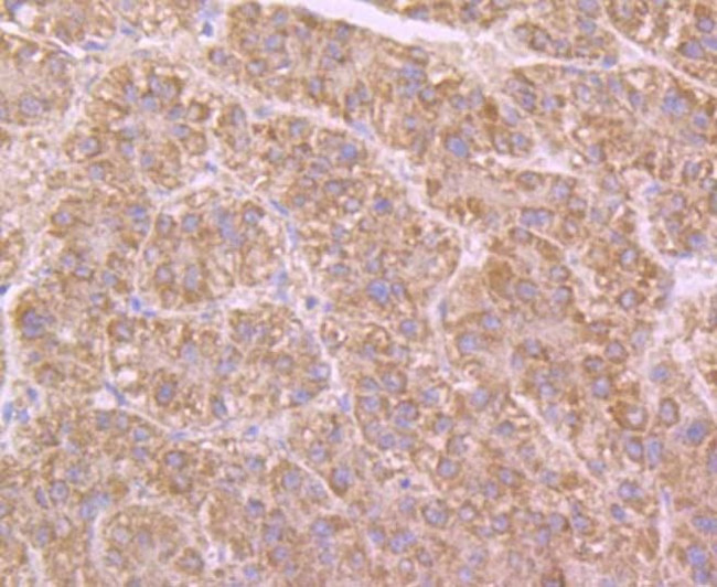 Butyrylcholinesterase Antibody in Immunohistochemistry (Paraffin) (IHC (P))