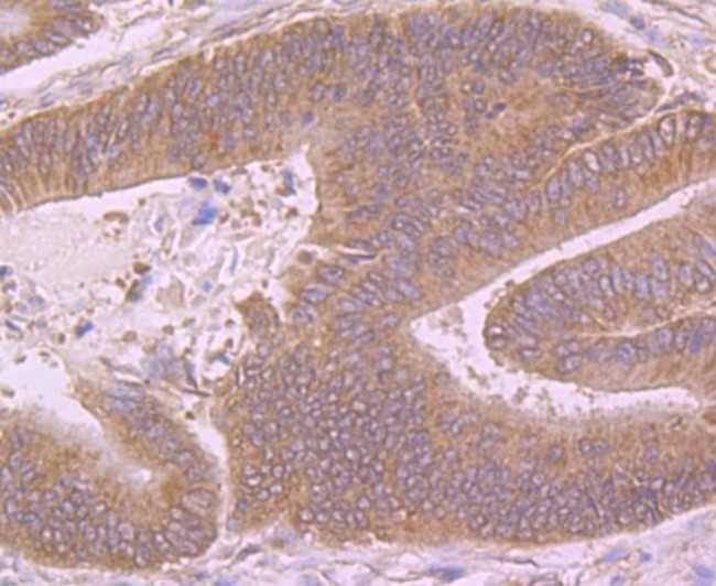 Butyrylcholinesterase Antibody in Immunohistochemistry (Paraffin) (IHC (P))