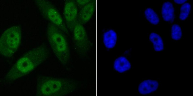 VDR Antibody in Immunocytochemistry (ICC/IF)