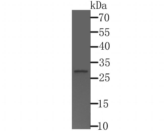 CTDSPL Antibody in Western Blot (WB)